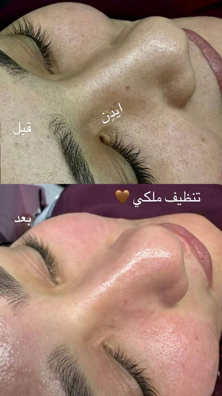 صالون أيدن العنوان السماوه ال معالي ع شارع مقابيل كريم ال خلف
للحجز والاستفسار يرجى مراسلتي على الواتساب 

‭0787 607 2478‬
