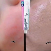 كريم ميلانو • تفتيح عميق • مناطق حساسة