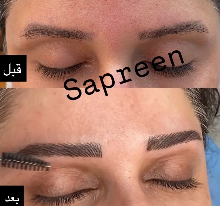 تحويل تاتو قديم. الى موديل الشعيرات. 
للحجز والاستفسار مراسلة البيج او الواتس اب ***********
