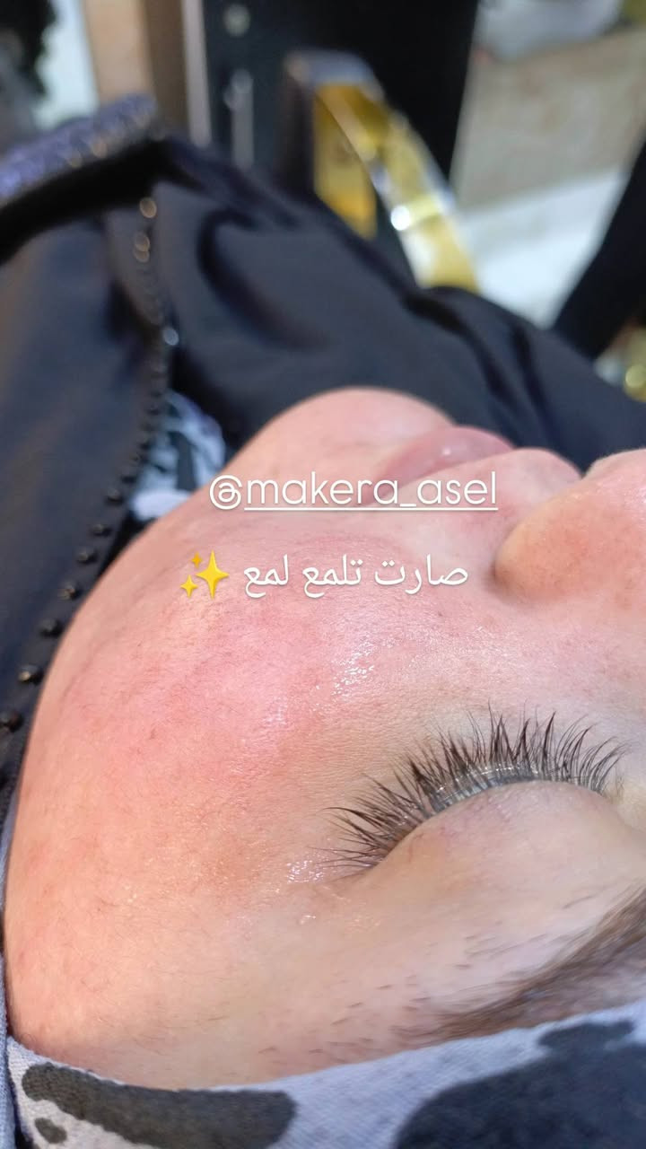 #تنظيف_بشرة بصالون يختلف 
تخلصي من الرؤوس السوداء والجلد الميت مع تنظيف بشرة عميق ومريح والنتيجة فورية 
للحجز ***********
