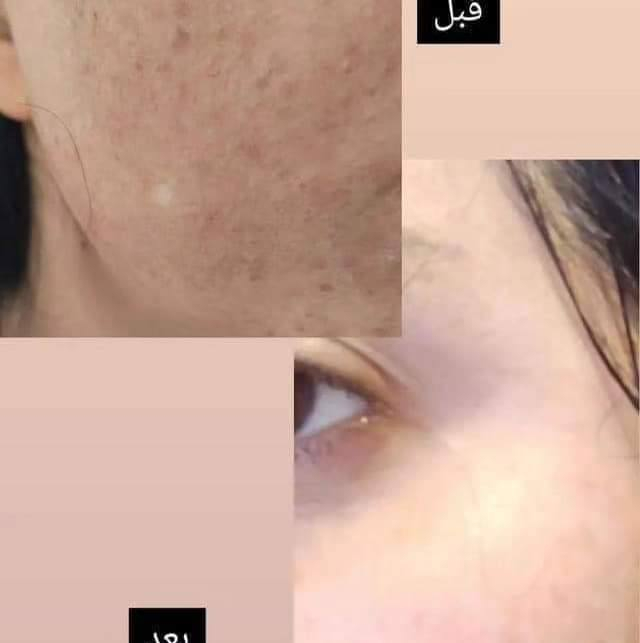 بنات توفرت الخلطة


**إذا كنت صاحب هذا الإعلان وتريد حذفه لأي سبب، رجاءا أرسل رسالة إلى الدعم الفني**