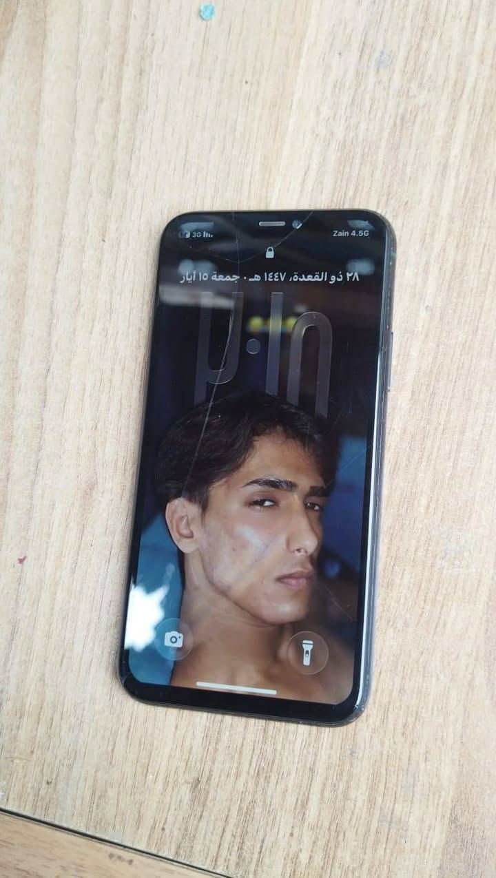 السلام عليكم شباب عندي 11 برو ذاكره 64 بطاريه 100 مبدله اصليه والله ولا تصرف ومبدل شاشه اصليه 3 خيارات وبيها فطر مثل ما موضح بالصور فيس ايدي يحتاجله برمجه باقي كلشي شغال بدون مشاكل الجهاز يخبل والله مال جناي ب 175 وبي مجال مكان بغداد غزاليه *********** وتساب + بيع او مراوس 
ادمن🤍
