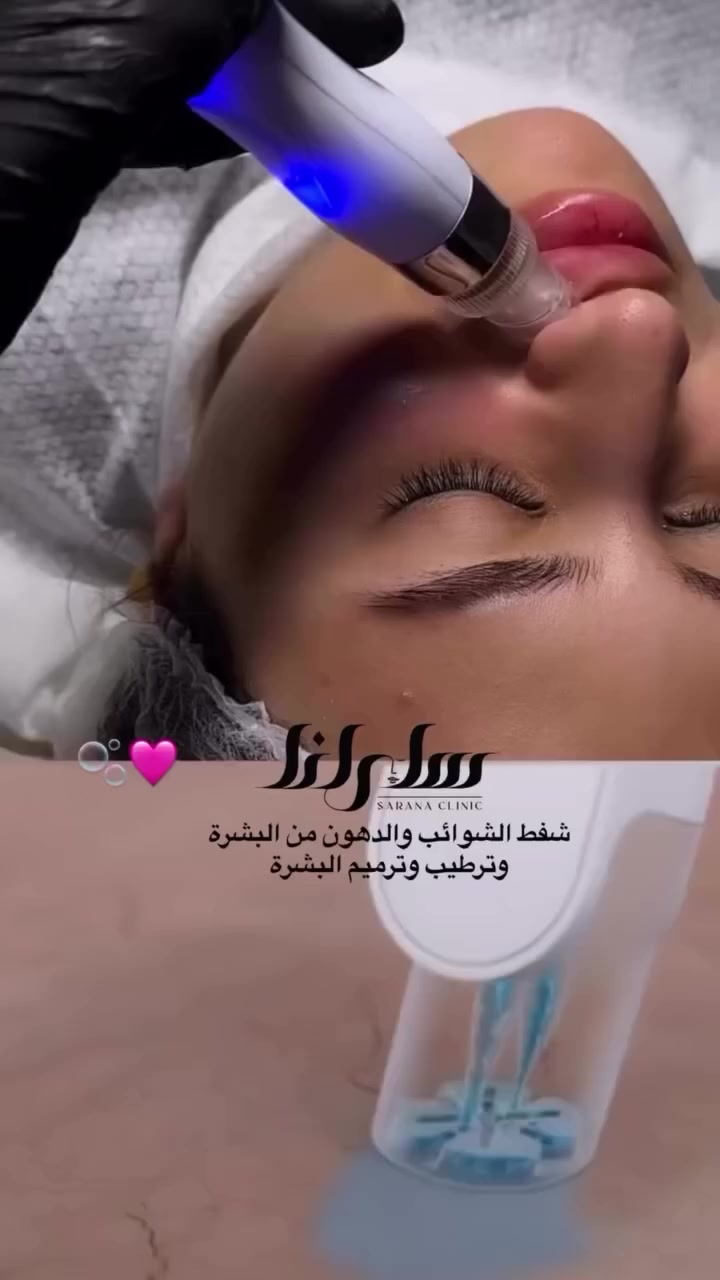 عنواننا النجف ركن السلام جامعه(الاربع شوارع) مجاور ازبري قرب يو كافيه
للحجز ***********

