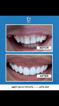 عيادة اسنان • تقويم اسنان • تبييض الاسنان