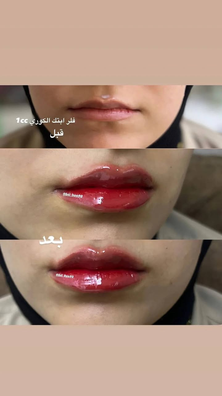 الحجز خاص 😍


**إذا كنت صاحب هذا الإعلان وتريد حذفه لأي سبب، رجاءا أرسل رسالة إلى الدعم الفني**