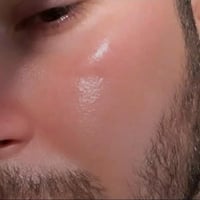 تبييض وجه • كلف ونمش • توصيل مجاني