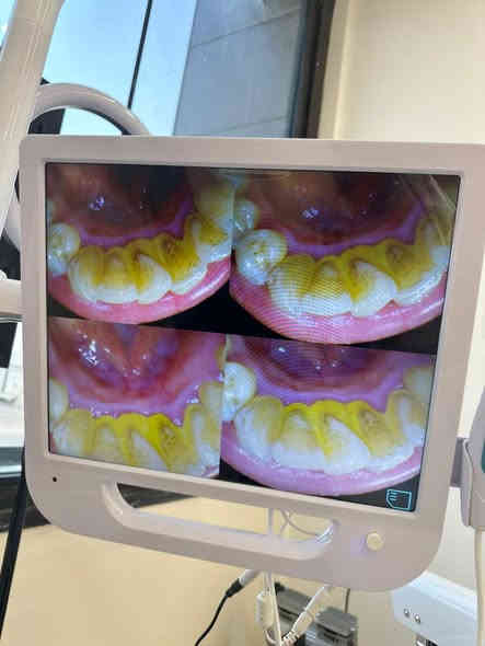 السلام عليكم / منشور للفائده                                                      الي عنده مثل هاي التكلسات يراسلني 

(العمل مجاني🔥 )

📍الحله شارع 40 مجاور صيدليه سلامتك 
***********

ننتظركم بكل حب ♥️
