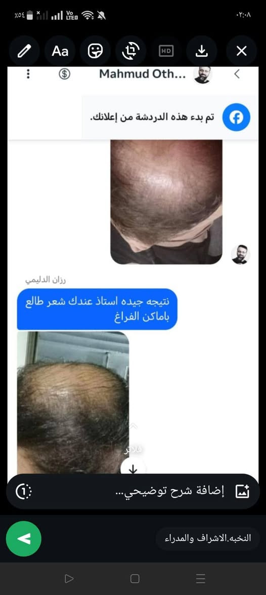 مـرگـز شـ ـمـس وكيل شركة فوريفر الامريكية في العراق


**إذا كنت صاحب هذا الإعلان وتريد حذفه لأي سبب، رجاءا أرسل رسالة إلى الدعم الفني**