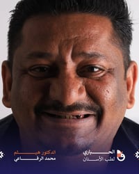 زراعة اسنان • ابتسامة تجميلية • المسيب