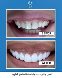 عيادة أسنان • تقويم أسنان • البصرة المطيحة