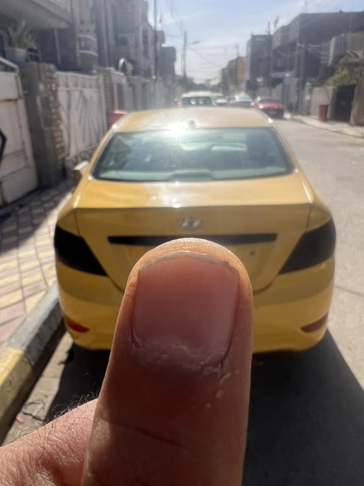 سلام عليكم اكسنت ١٤ امريكي حادث باب سايق وجاملغ بس باب مبدل ليبل واحد سياره حلوه كامله مصفره هييه وغرامات رقم بغداد نكليزي تخم تاير حداده جديده باتري جديد تبريد جديد مدوشمه ارضيه +كشنات +تنته سياره ماتذب عليه ربع كبل شارع عنوان بغداد الزعفرانيه  السعر ٧٥
***********
