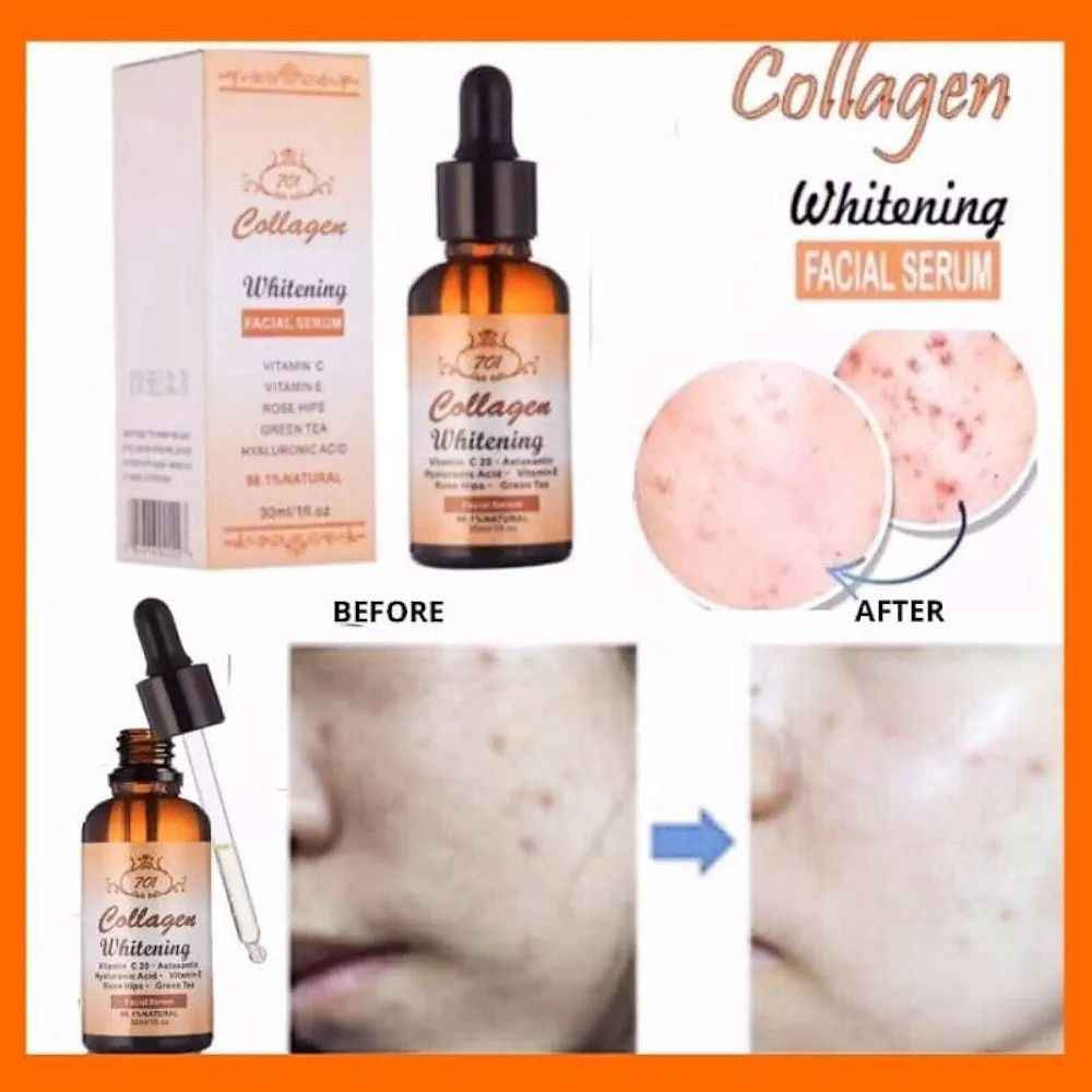 #سيروم_701 
جهزي بشرتك ووجهك للعيد 👌👌 وخلي الكل يسألك شنو مدايرة مع ❤❤❤❤

🚨🚨 سيروم  الكولاجين 😌😌
 
السيروم الخرافي 👌👌
 سيروم الكولاجين 🫶🏻🫶🏻مصل تفتيح الوجه بالكولاجين يتكون من الكولاجين وفيتامين A و E الذي يرطب ويشد البشرة ويقلل الخطوط الدقيقة على الوجه  مصل تفتيح الوجه بالكولاجين مع فيتامين سي👍  سيروم بتركيبة ناعمة غير لزجة تحتوي على تفتيح وكولاجين وفيتامين سي وغني بمكافحة الشيخوخة.  مع الاستخدام المنتظم ، يمكن أن يخفي المسام و التجاعيد الدقيقة على الوجه ويجعل بشرة الوجه تبدو مشرقة وصحية وناعمة.  طريقة الاستخدام: ضع 2-3 قطرات من السيروم على راحة اليد ثم ضعه على بشرة الوجه التي تم تنظيفها حتى خط العنق بالتساوي.  استخدمي السيروم قبل استخدام الكريمات أو مستحضرات التجميل الأخرى في الصباح والمساء بانتظام

سيروم #701 بغداد, العراق


**إذا كنت صاحب هذا الإعلان وتريد حذفه لأي سبب، رجاءا أرسل رسالة إلى الدعم الفني**