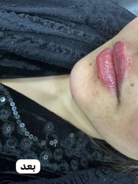 عياده الدكتورة شذى عبد الأمير   مسويتلكم عروض💖 عل فيلر ✨ بمناسبة الفلن...