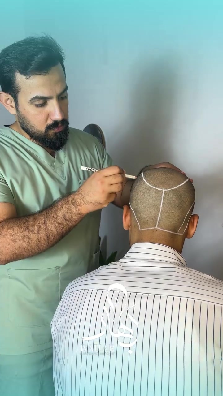 عيادة بهار | Bahar Clinic 🌿

استرجع شعرك… واستعيد ثقتك بنفسك ✨
مع أحدث تقنيات زراعة الشعر وبنتائج طبيعية مميزة 🔥

✅ كثافة طبيعية
✅ عناية متكاملة بعد الزراعة
✅ متابعة بإشراف مختصين
📞 *********** | ***********

احجز الآن قبل انتهاء عروض ✨

#عيادة_بهار #BaharClinic #زراعة_الشعر #عروض_العيد #الناصرية #HairTransplant
