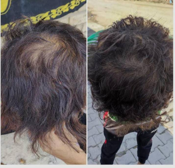 مع منتجات لدورا الأيرانيه لا تحتار
توصيل لجميع المحافظات العراق 🇮🇶
*********** واتساب 
نتائج عمل منتجات شركه لدوره 💪🔥
