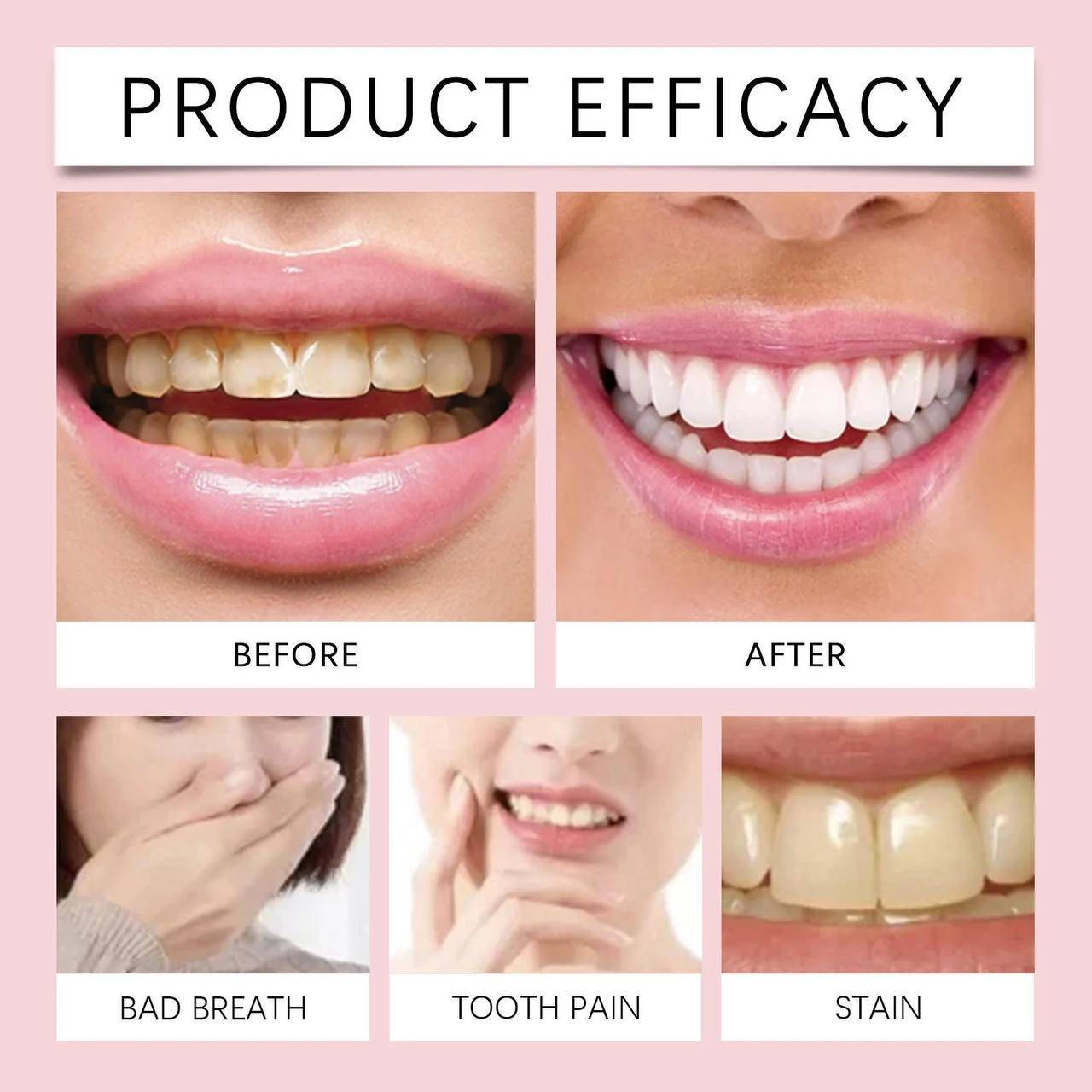 ✨ معجون أسنان SADOER Whitening ✨
نظافة عميقة وابتسامة أكثر إشراقاً من أول استخدام 😁

متوفر بعدة أنواع لاحتياجاتك المختلفة:
🦷 تفتيح وإنعاش
🦷 مضاد للبكتيريا
🦷 مهدئ للثة
🦷 مضاد للاصفرار
🦷 تنظيف عميق

حماية يومية… نفس منعش… وبياض يدوم 💙
اختار النوع المناسب إلك وخلي ابتسامتك تحچي


**إذا كنت صاحب هذا الإعلان وتريد حذفه لأي سبب، رجاءا أرسل رسالة إلى الدعم الفني**