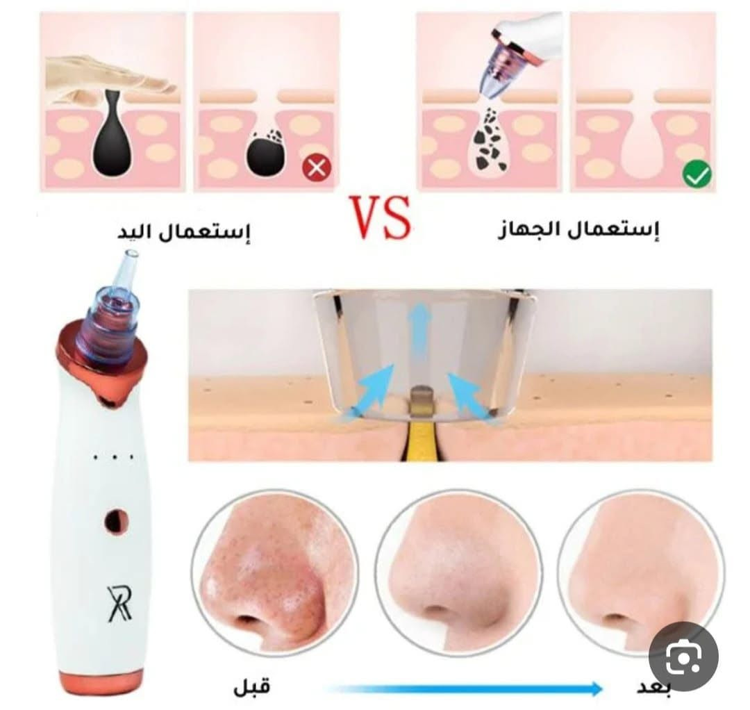 🌸جهاز شفط الدهون من الوجه والبثور السوداء للرجال والنساء🌸
مميزات الجهاز 🍃 :
تنظيف عميق  للبشرة ✅ شفط دهون الانف و الوجه إزالة الرؤوس السوداء ✅حمايه البشره من ظهور حبوب ✅شفط الحبوب والروؤس السوداء ✅يحفز انتاج الكولاجين في البشرة✅ إزالة خلايا البشرة الميته 
الجهاز قابل لإعادة  للشحن 
⚡️⚡️توصيات مهمة قبل الإستعمال⚡️⚡️
يفضل استخدام جهاز البخار قبل البدء بإستخدام هذا الجهاز واذا لم يتوفر يمكن استخدامه بعد الاستحمام
كما يفضل تشغيله بالتدريج وتجنب تشغيله على اقصى قوة الا عند اللزوم للحفاظ على بشرة الوجه من الضرر الذي ينتج عنه لون ازرق تحت الجلد.
يحبذ استخدام تونر او ماء ورد او اي غسول بشرة مع الجهاز
شحن الجهاز لمدة ساعتين قبل التشغيل.
السعر ياسلام ب 199 درهم 😍
التوصيل مجانا لجميع مدن المغرب


**إذا كنت صاحب هذا الإعلان وتريد حذفه لأي سبب، رجاءا أرسل رسالة إلى الدعم الفني**