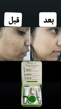 سيروم اكس واي • بقع داكنة • نضارة بشرة