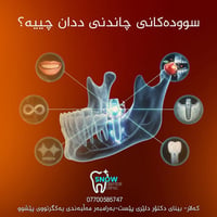سوودەکانی چاندنەوەی ددان چييه؟  1- جوانی: چاندنی ددان دەبێتە هۆی بەخشی...