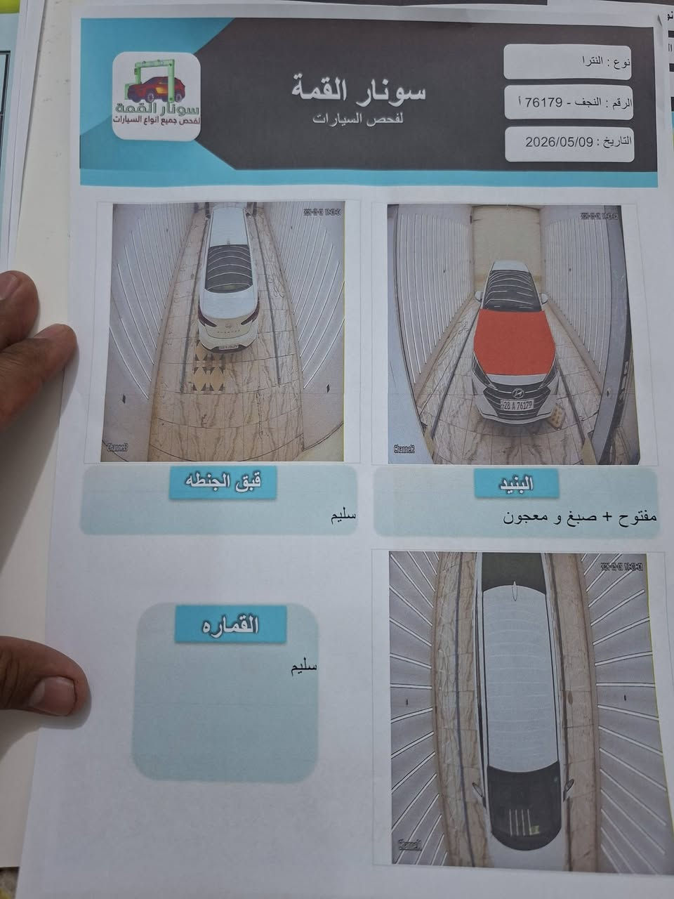 النترا ٢٠٢٠ابيض اللون بسمي للبيع السعر ١٢٠ للاستفسار ***********
