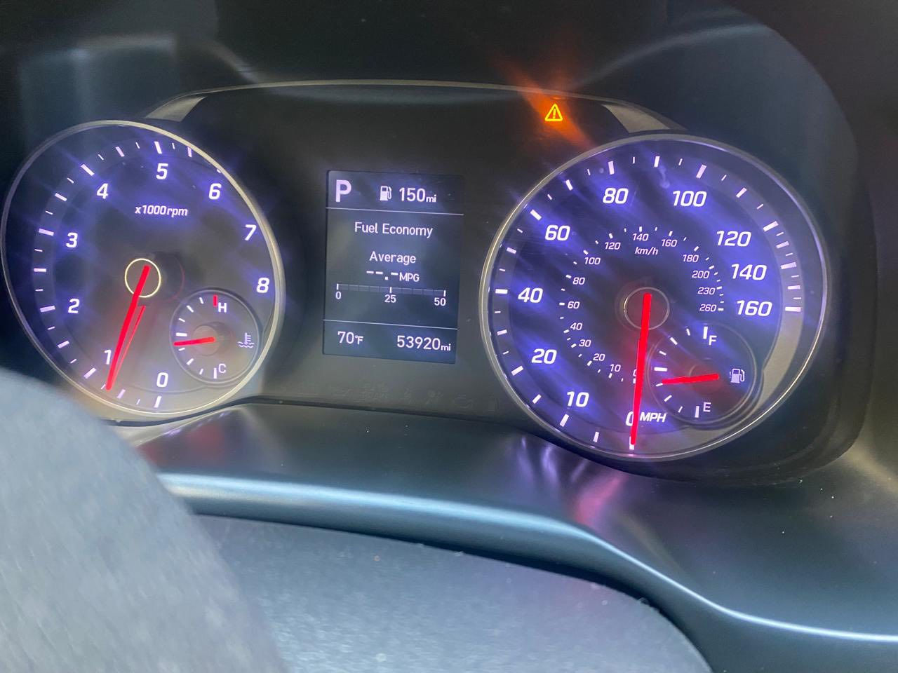 للبيع فقط هونداي النترا حمره موديل ٢٠٢٠ فئة سبورت فول مواصفات فتحة سلايد روف وكشنات تدفئة كهرباء محرك ١٦٠٠ تيربو السيارة داخله معوقين تاخذها بوكالة من الشخص وتسجل سنة ٢٠٢٧ شهر ال١ يعني بعدلها سنة والصبغ والنقوصات مرفقة بالسونار سونارها حديث البارحة سويته 
مكان السيارة بغداد-بوابه العراق
السعر :١٣٣ورقة وبي مجال بسيط
مكلف بالنشر 

رقم صاحب السيارة : *********** ابو ابي
