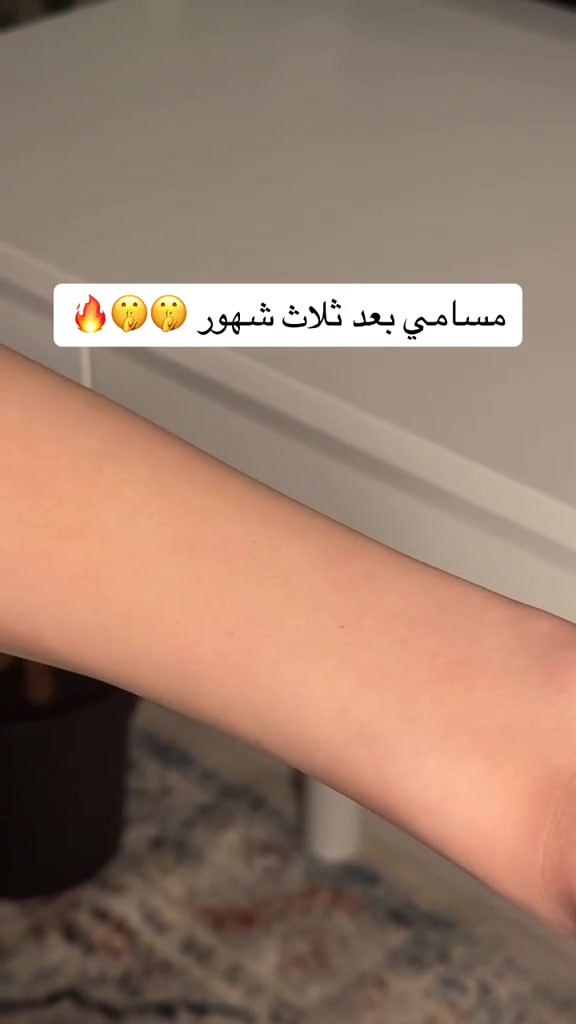 هلو بنات 
تردين منتج يخفف الج الشعر بلجسم والوجه ويزيلة وية الاستمرار تعالي لكيتلج الحل زيت طبيعي ومعصور عل بارد زيت السعد مابي اي اثار حانبية
ورة متزيلين الشعر تخلين منة راح يمحيلج الشعر وانسي شي اسمة مسامات او جلد الوزة
راسليني خاص وادللي

#لقطة #اكسبلور #اكسبلورر_2025 #اكسبلور_فلو #عرب #ضحك #الامارات #اكسبلور_explored #اكسبلور_لايك #عرب_فوتو #تصويري


**إذا كنت صاحب هذا الإعلان وتريد حذفه لأي سبب، رجاءا أرسل رسالة إلى الدعم الفني**