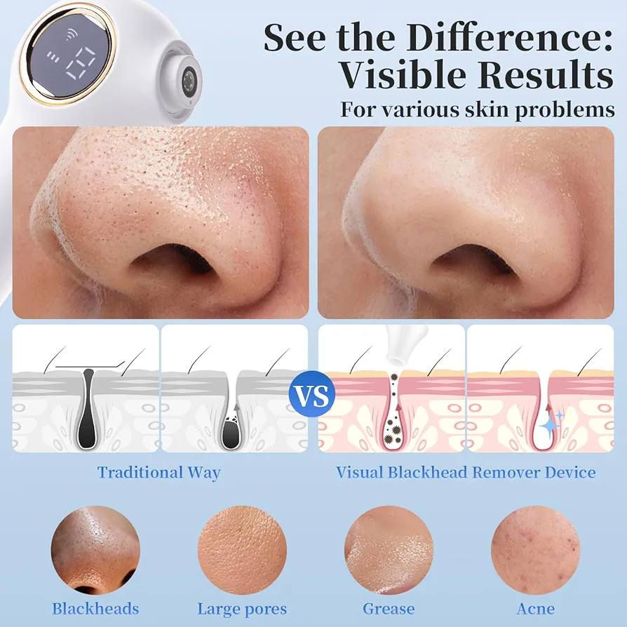 جهاز شفط وازالة الرؤس السوداء مع كامرة السعر 30الف مع التوصيل


**إذا كنت صاحب هذا الإعلان وتريد حذفه لأي سبب، رجاءا أرسل رسالة إلى الدعم الفني**