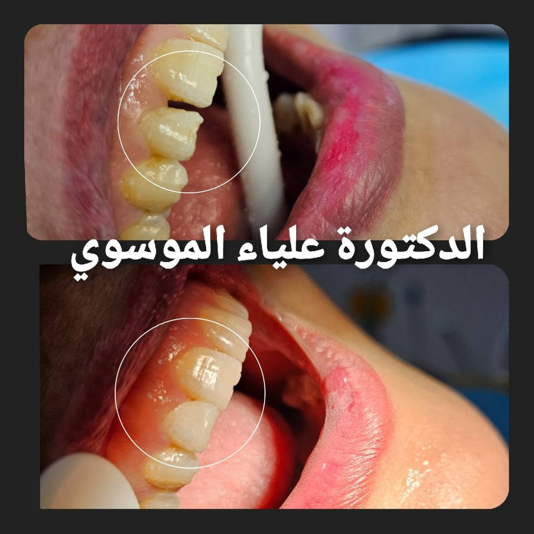تتواجد الدكتورة علياء الموسوي يوميا من ساعة ٤ إلى ساعة ٩ مساءا في المشتل شارع المطبك للاستفسار ***********
