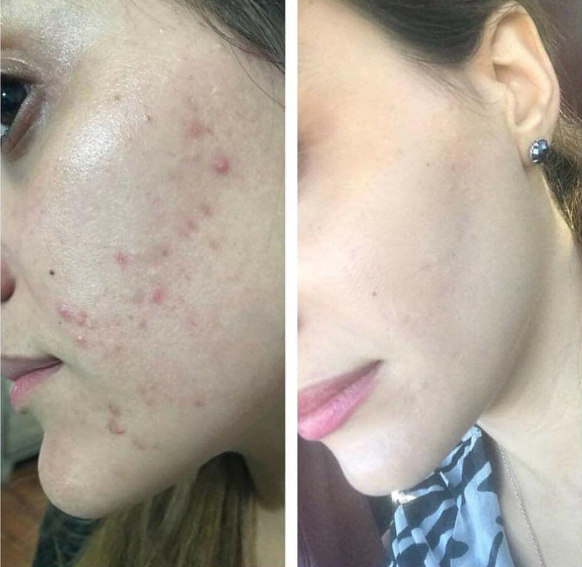 اقسم بالله العلي العظيم خلطه مجربه ومظمونه
فوائد الخلطه مع الصابونة :
1- تفتيح وتوحيد لون البشرة 
2- إزالة التصبغات و البقع السوداء
3-  تضييق المسام وتنعيم البشرة
4-  يقضي على النمش والكلف 
5- تبيض البشرة من 5 الى 7 درجة
6-ازالة حب الشباب وآثاره
  
اظافه الئ 👇

مسمن مورد ينطي امتلاء للوجه مع تبيض وتوريد شغله كلش روعه حرفيا ايجنن اضافه الئ صابونه مسمنه مورده تستخدم للوجه  وايضا تستخدم للمناطق الحساسه رووووعه 👌
*********** واتساب
