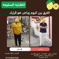 نزول وزن • اعشاب طبيعية • المقداديه