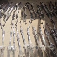 حله شارع ٨٠ • فتح صدر • مشط ستيرن