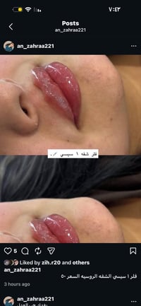 فلر وجه • فلر شفه • نضارة فورية