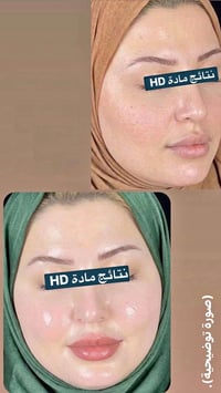 بشرة صافية • إشراقة • مكوّن واحد