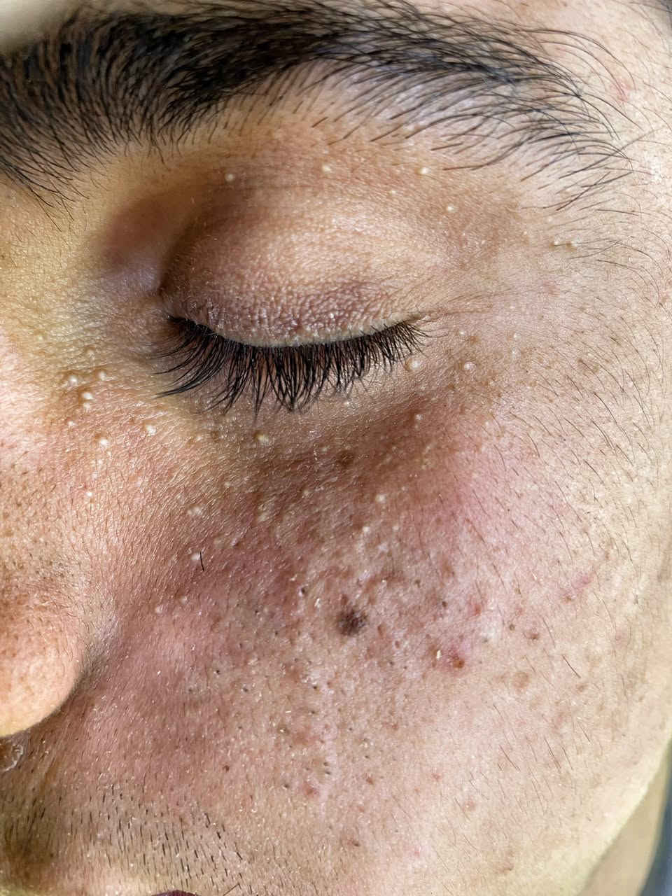 تعاني من الرؤوس السوداء والبشره الدهنيه🧏🏿🧏🏻

ماعليك بس تحجز 📞📞
ازاله الرووس السوداء 
التقشير المائي وازاله الدهون🧑🏻‍🔬
التقشير الكاربوني 🧔🏻‍♀️
للحجز مراسله الحساب او الاتصال 
***********📞
