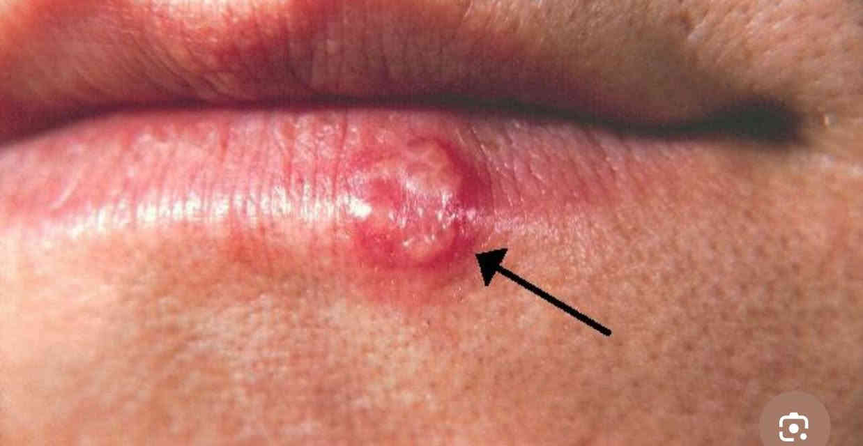 📍مجانا لفتره محدوده 
 سلام عليكم , الي عنده مثل هاي الحالات يتواصل ويايه نعالجها اله  

العنوان / كربلاء الجمعيه خلف مول الحارث مجاور سيطرة الاحياء او كراج المخيم 
للحجز التواصل على واتساب  
* ***********
