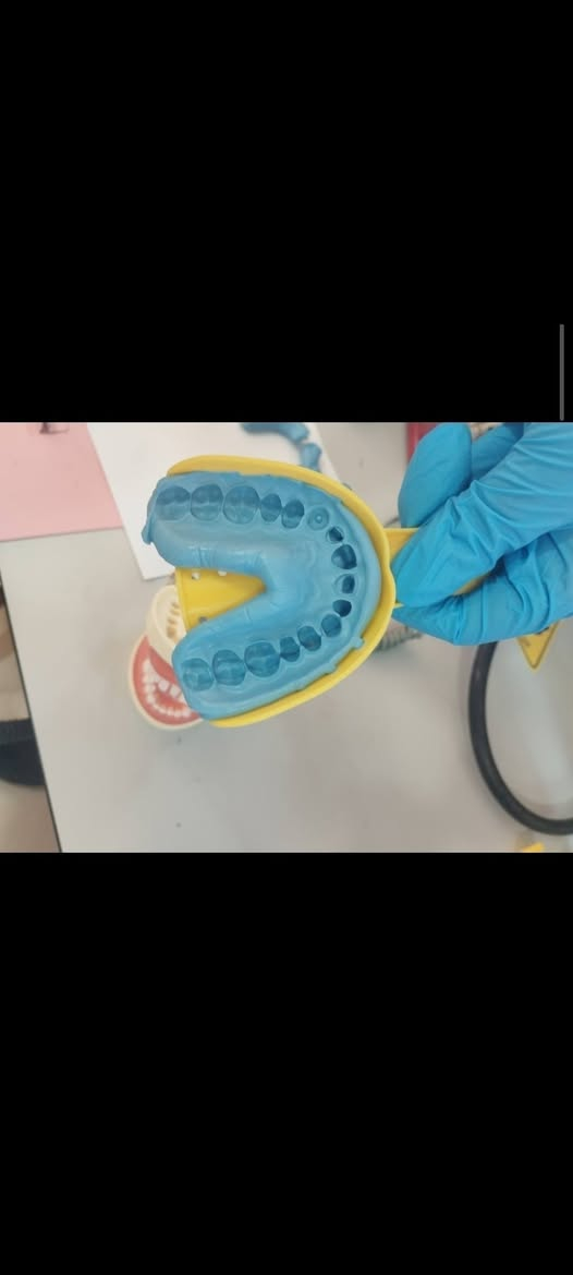 علاج مجاني
السلام عليكم ورحمة الله وبركاته للمرضى الاعزاء يتوفر لدينا :-

قلع سن.

 حشوة اعتيادية.

 تنظيف الاسنان من التكلسات.

تبديل حشوة قديمة بحشوة ضوئية.

طقم اسنان للفكين الاسفل و الاعلى.

مجاني في  عيادات جامعة النور التخصصية لطب الاسنان بإشراف الدكاترة المتخصصين في طب الاسنان الاستفسارات والأسئلة العامة الاتصال على الرقم التالي :
***********
الدكتور واثق عبدالله حسن 
ابتسم وانت مرتاح
