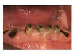 السلام عليكم 
الي عنده هيج تسوسات او كسر بالسن محتاج قلع نكدر نعالجهم مجاناً في عيادات الجامعه الوطنيه 
(العمل مجاناً وباشراف اطباء اختصاص )
للاستفسار:***********
