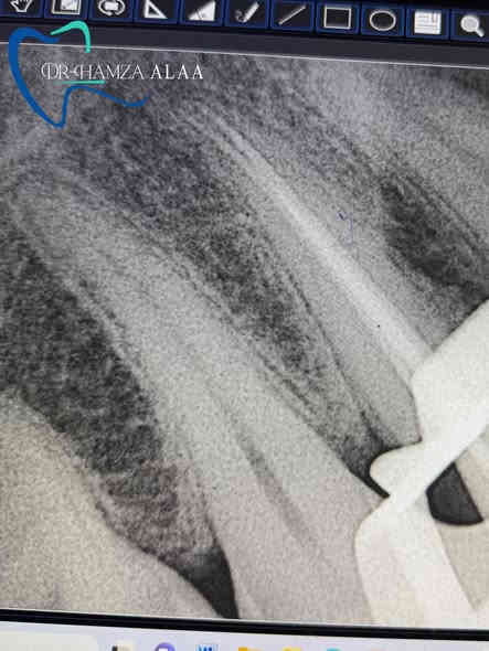 العنوان بسماية الشارع العام 📍
  للتواصل مراسلة الصفحة 📩
 او عن طريق الواتساب *********** 📞
