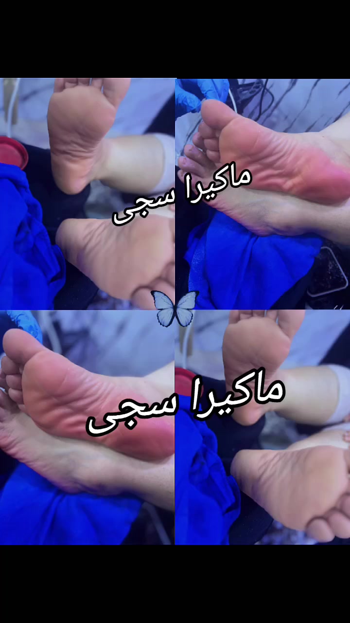 تسريح الشعر بانوعه بنسب لاسعار تتوفر خدمه منزليه لبيتج وانتي مرتاحه ❤️🤍🤍
🩵❌🩵هيدوفيشل ضهر +حمام مغربي+ بدكير هديه  كل هاذا ب25الف
🩵❌🩵حفافه+تنضيف بشره+ بدكير ب15بس (هديه وياهن تنضيف رقبه هيدوفيشل)
🩵❌🩵حمام مغربي+بدكير قدم+تنضيف بشره 
25الف هديه وياهن (حفافه وجهه)
🩵❌🩵مسؤيه عروض يجنن 
حفافه وجهه+تنضيف بشره عميق+بدكير قدم 
+معالج بارد للشعر بتقنيه جهاز نانو شعر +تنضيف ايدين وازله جلد ميت هديه كل هاذا ب30الف 
🩵❌🩵شيره فول بدي ب٣٥


**إذا كنت صاحب هذا الإعلان وتريد حذفه لأي سبب، رجاءا أرسل رسالة إلى الدعم الفني**