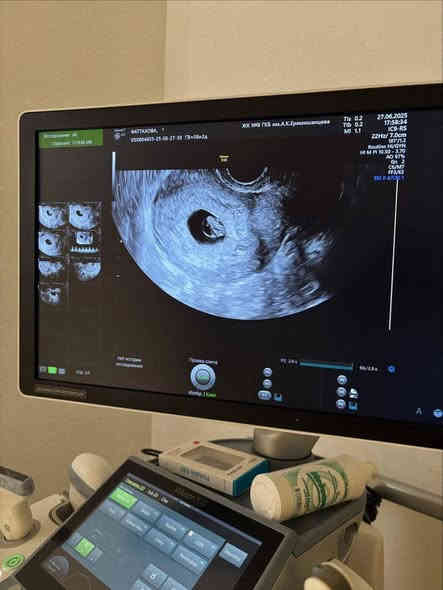 الدكتورة
                 #خنساء_حميد_الدليمي
طبيبة اختصاص بورد(دكتوراة ) جراحة الأمراض النسائية والتوليد
#ماجستير_في_معالجة_العقم
معالجة مشاكل العقم المعقده والممتده لسنوات عديدة
#الفحص_بجهاز_السونار_الحديث_والدوبلر
#مجمع الرازي الطبي ابوغريب الحصوه
مجاور صيدلية غفران عامر سامي
للحجز والاستفسار ***********_***********
