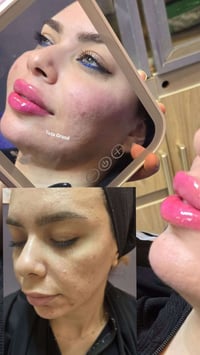 نحن صناع الجمال   مع  تــდــــوته كراند  انتي اجمل 😇 المراجعه قبل ٤ اش...