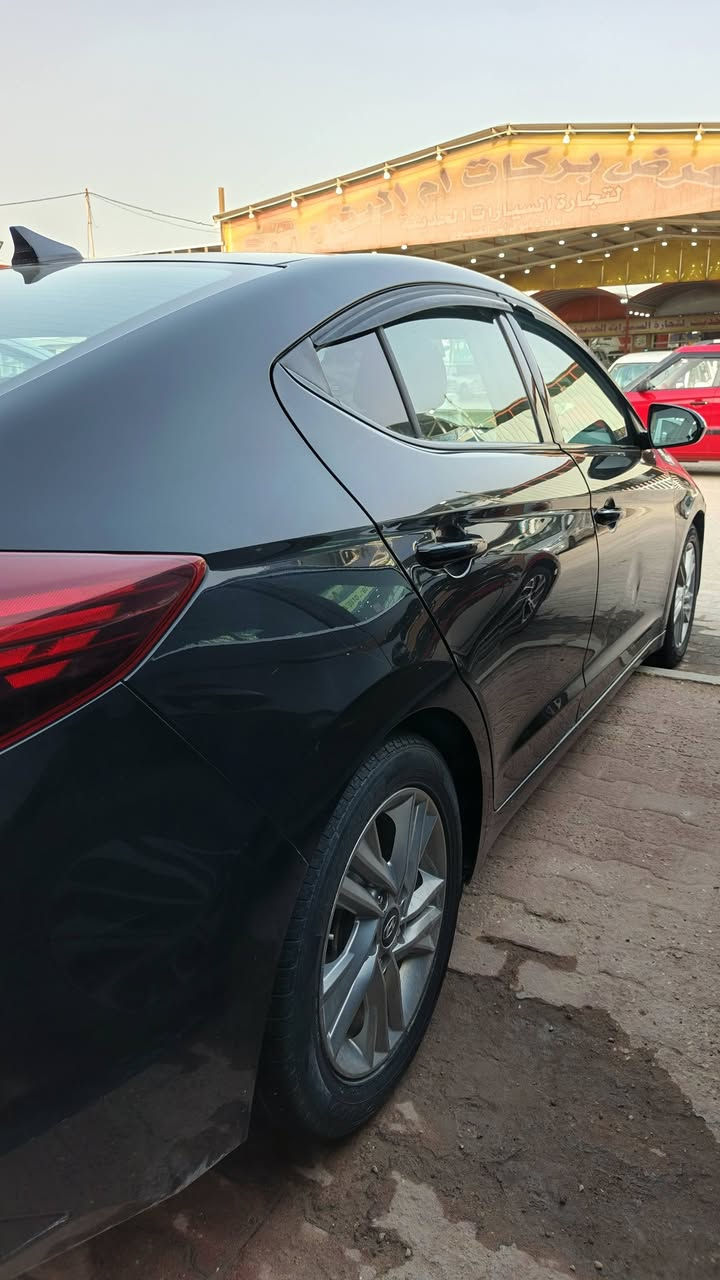 السلام عليكم
هيونداي النترا 2020 وارد امريكا 
حادثها جاملغ ايمن امامي فقط وبيها بارد قليل 
سونارها مرفق بلمنشور 
رقم نجف انكليزي بأسمي 
السعر 133 وبيها مجال بسيط مكاني نجف
للاستفسار***********
