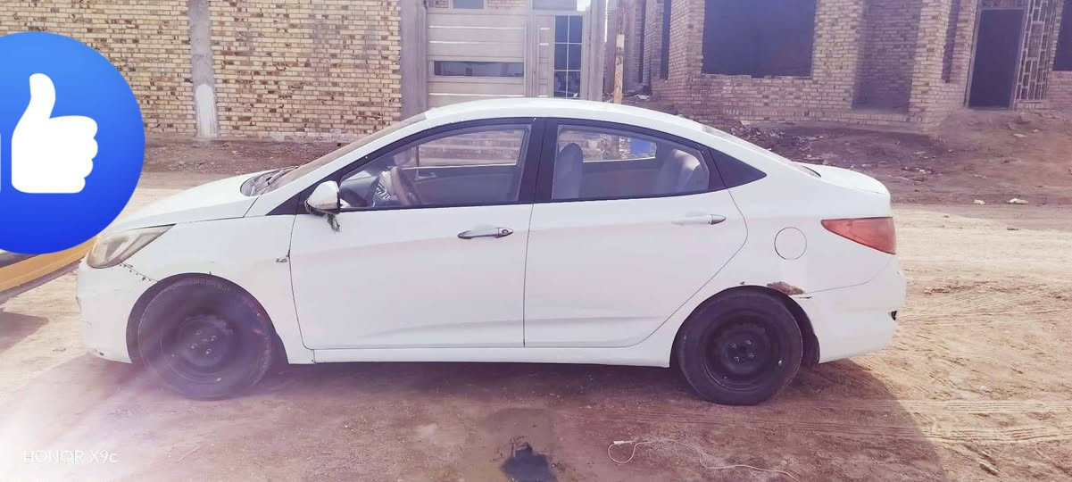 اكسنت 2015خليجي مكينه كير كفاله وشرط تخم تاير جديد حداديه جديده بيه طخات بسيطه تجي وتشوف بعينك وتكلب وتقتنع
اني مكلف بنشر رقم صاحب السياره *********** السعر 72وبيه مجال للطيبين
