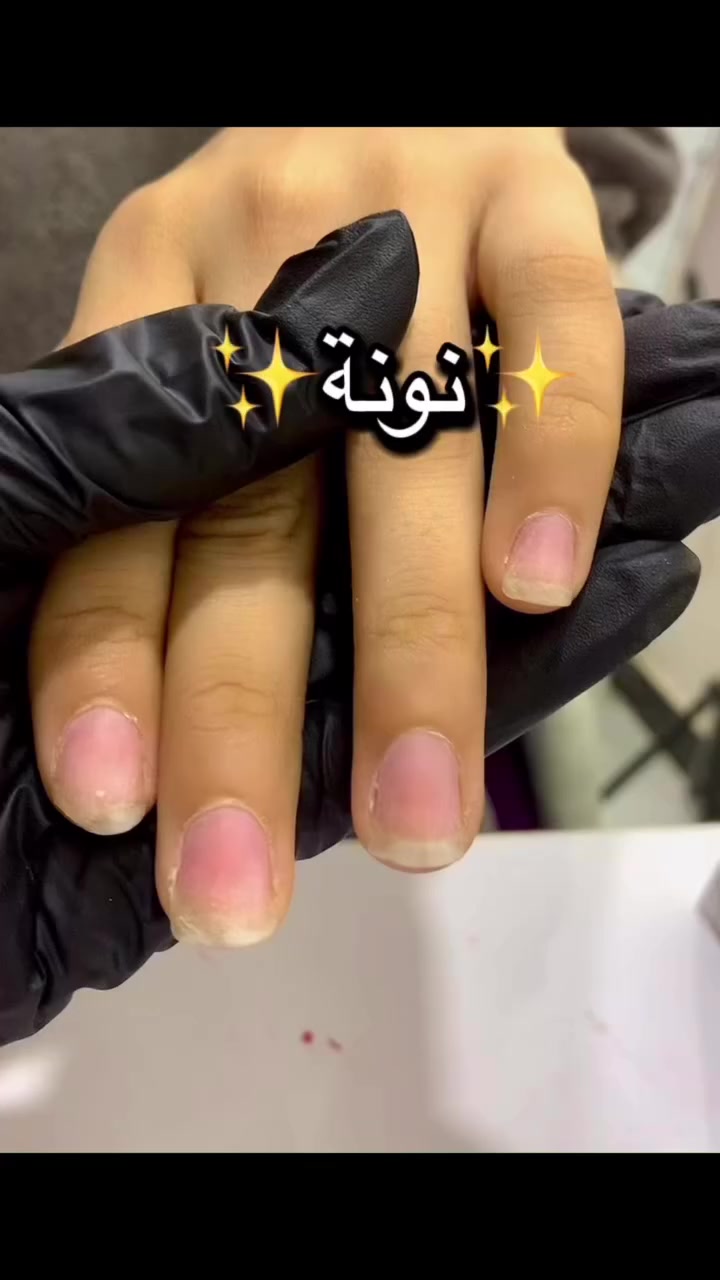 #اكريلك #دزاين #صالون #نونة


**إذا كنت صاحب هذا الإعلان وتريد حذفه لأي سبب، رجاءا أرسل رسالة إلى الدعم الفني**