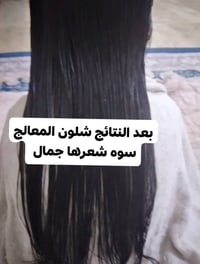 نتائج زبونة • تساقط شعر • شعر عكش