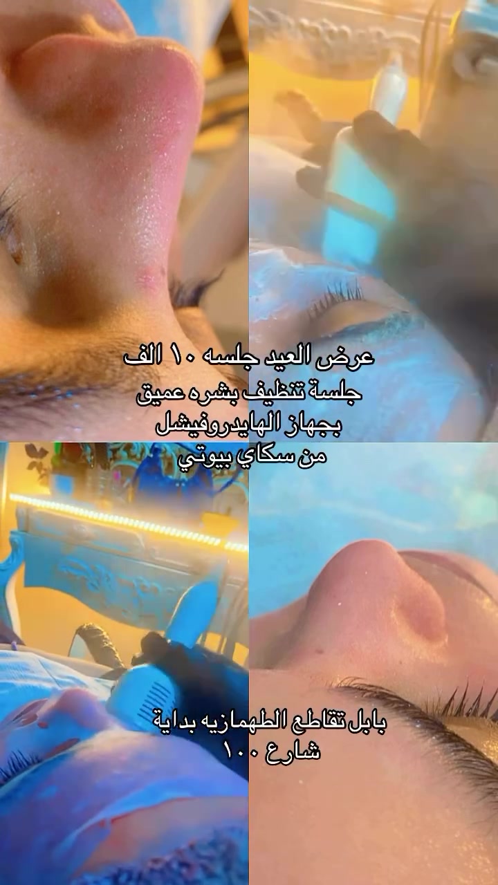 دخلو شوفو العروض التجنن مبقه شي ٣ ايام للعيد وتخلص العروض😌😌😌😌


**إذا كنت صاحب هذا الإعلان وتريد حذفه لأي سبب، رجاءا أرسل رسالة إلى الدعم الفني**
