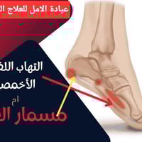 # النتوء العظمي للكعب  عبارة عن نتوء عظمي بارز في النسيج العضلي اللين ...