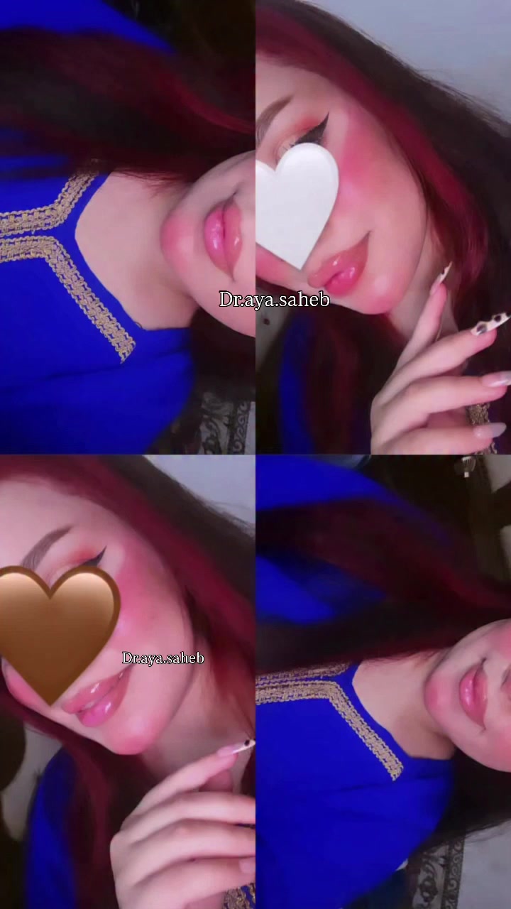 رڤيو مراجعتي بعد حقن فلر الشفة ✨🤍#فلر_شفايف #فلر #تجميل #الديوانية #فلر_شفة


**إذا كنت صاحب هذا الإعلان وتريد حذفه لأي سبب، رجاءا أرسل رسالة إلى الدعم الفني**