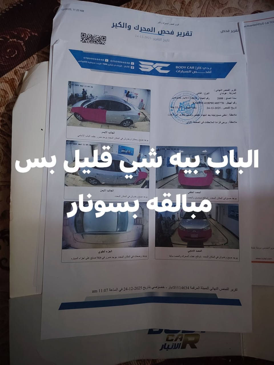 سلام عليكم افانتي  2008البيع  السعر  97وبيه مجال   تحويل  مباشر  وهاذ السونار سيارة  لاتبديل  ولا داخل   سيارة حلوه  مكان سيارة  فلوجه  ***********تواصل عل خط  فقط
