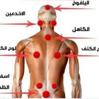 حجامة علاجية • أدوات معقمة • خدمة منزلية